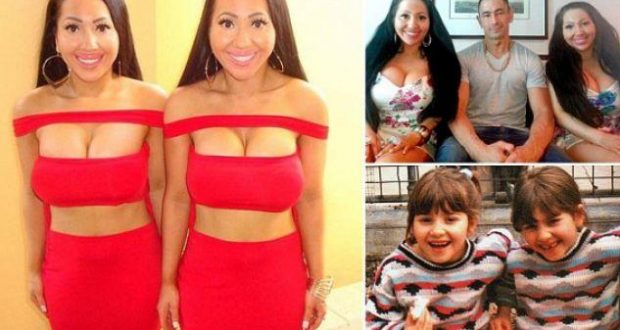 FOTO/ Binjaket që do të martohen me të njëjtin burrë