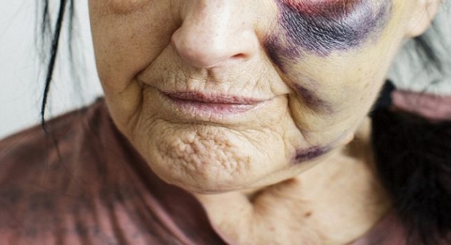 Ndodh në Elbasan, 30 vjeçari dhunon me sende të forta nënën e tij