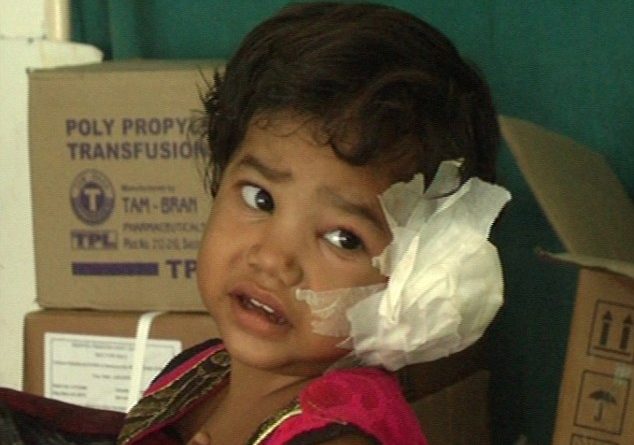 E frikshme! Fëmijës i heqin 80 krimba nga veshi