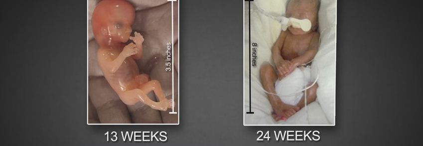 VIDEO/ Ja çfarë ndodh me beben gjatë abortimit