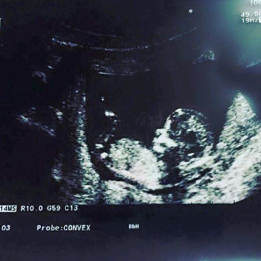 Akuza e këngëtarit për gruan: Më vrau vajzën