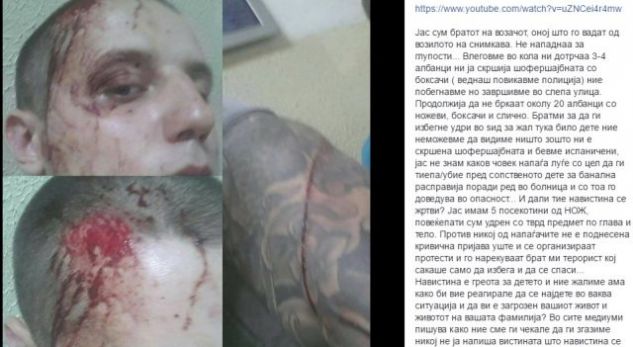 Shqiptaret hakmerren, rrahin vëllain e shoferit që vrau Almirin