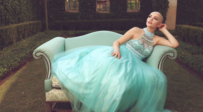 17 vjeçarja humbi flokët nga kanceri, fotosesioni i saj do t’iu lë pa fjalë