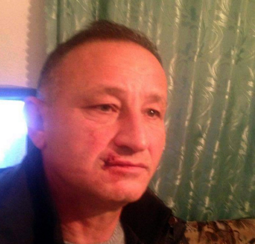 Tepelenë, dhunohet ish-drejtori i spitalit, akuzon burrin e drejtoreshës