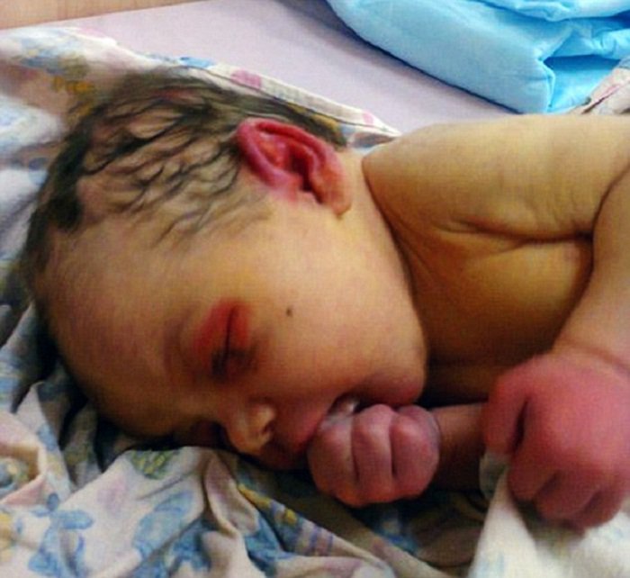 Milingonat hanë të gjallë vogëlushen, u neglizhua nga mamaja e saj