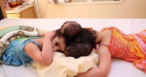 FOTO/ Binjaket lindin me kafkë të ngjitur