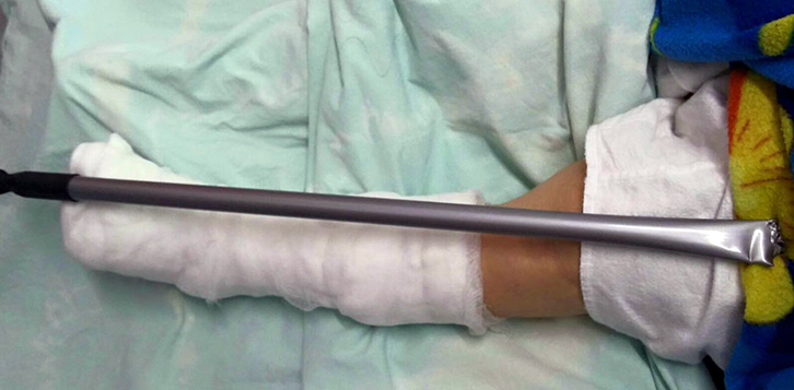 TIRANË/Nusja rreh vjehrrën më bishtin e fshesës