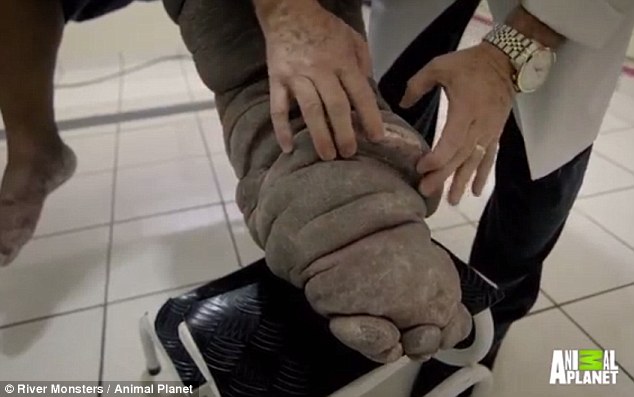 FOTO/ Pickimi i nje mushkonje që po e transformon burrin në një elefant