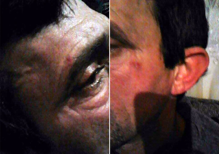 FOTO & EMRA/ Edi Rama në Lushnjë, Policia dhunon një fermer