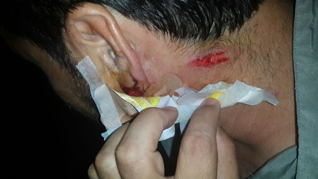 FOTO LAJM/ Peqin, edhe PDIU aktivizon krahun e armatosur, plagosen anëtarët dhe mbështetësit e PD