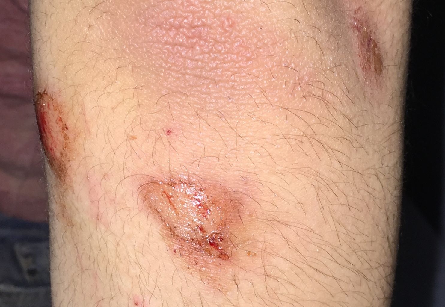 FOTO/ Policia, dhune ndaj pronarit te restoranteve “Era” dhe te birit