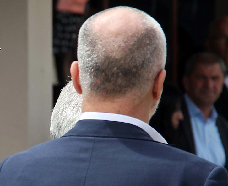 ILIR NIKOLLA/ Zgjidhja “në rrugë partie”, një alibi më e mirë për Ramën, sesa “pengesat kushtetuese”