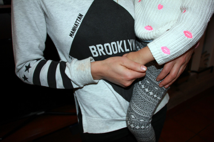 FOTO/ Itali, shqiptarja arratiset nga ngujimi dhe dhuna, kërcënohet me jetë nga njerëzit e burrit