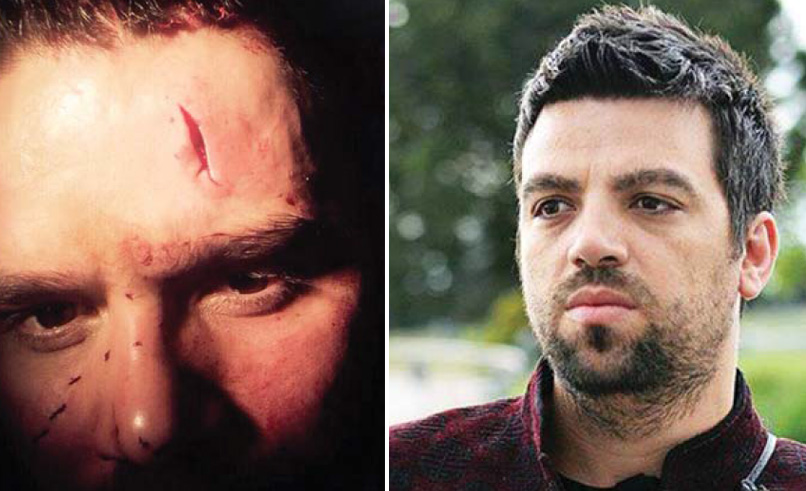 Rrëfehet Flori Mumajesi: Ja pse dhe si ndodhi sulmi Stines pas “Këngës Magjike”