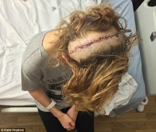 FOTO/ Gazetarja rëfim prekës për opreracionin e vështirë