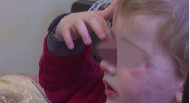 Durrës, dhunoi 3 vjeçaren, ndalohet kujdestarja e Shtëpisë së Foshnjes