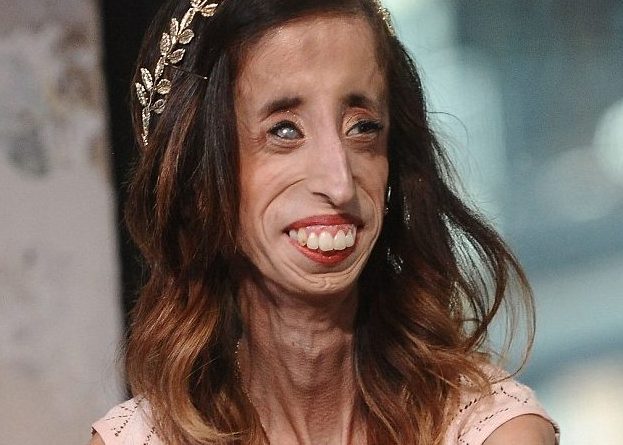 FOTO/ Flet “gruaja më e shëmtuar në botë”