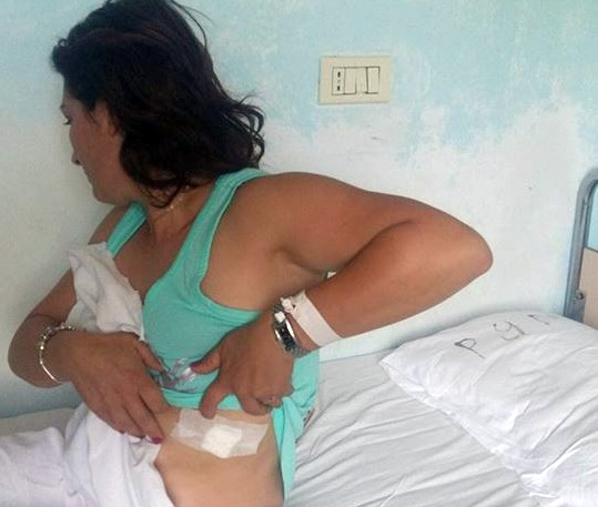 Gruaja e kosovarit që plagosi dy malazezë e dy maqedonas rrëfen sherrin në tragetin Ankona – Durrës