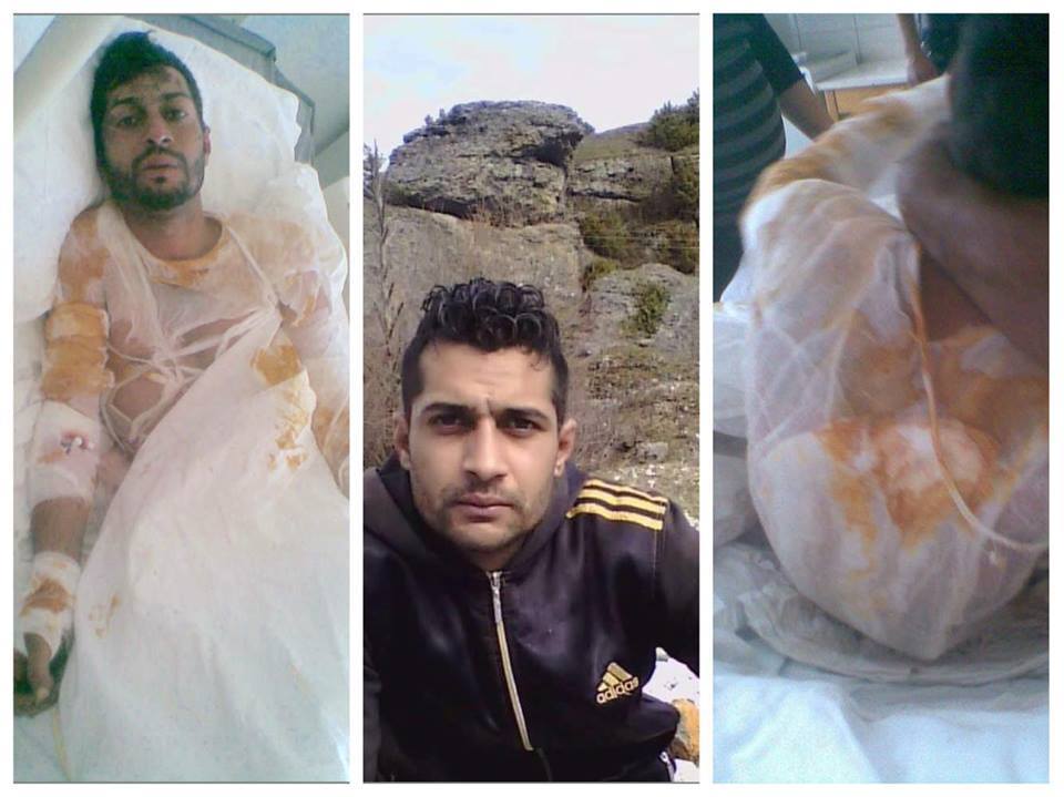 DRAMA E 19 VJEÇARIT NGA TROPOJA/I djegur, me shtëpi të djegur, jetim, nuk ka lekë për ilaçet që nuk ia jep spitali