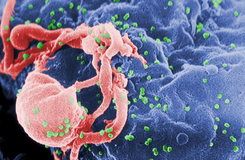 Mungojnë ilaçet për të sëmurët me HIV-AIDS. Të prekurit: Cënohet e gjithë terapia