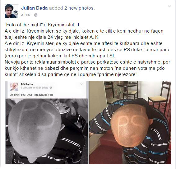 FOTO/ Julian Deda denoncon: Edi  Rama përdor persona me aftësi të kufizuara për fushatë