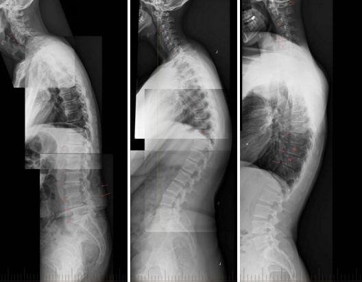 Telefonat smart, ja si u bëjnë kurrizin fëmijëve