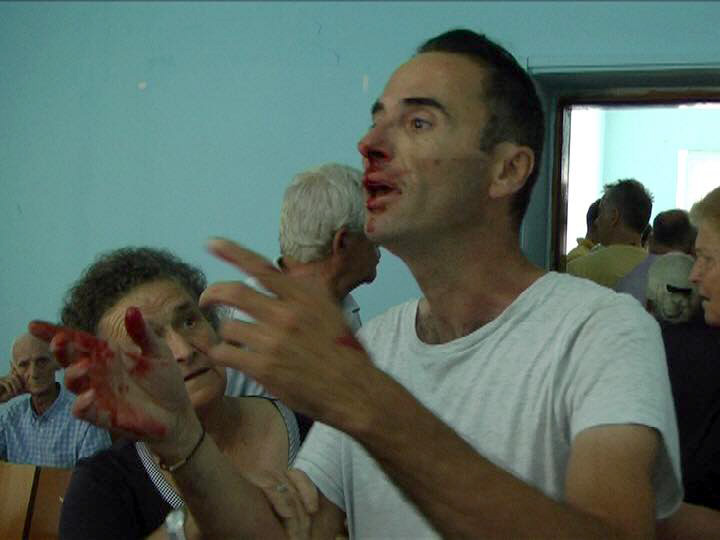 FOTO/ Dhunohen banorët e Himarës, apeli i tyre për Ardian Çipën