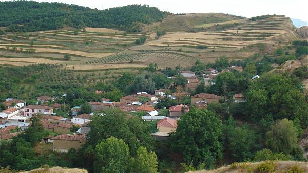 KORÇË/Të djegësh veten pa dashje