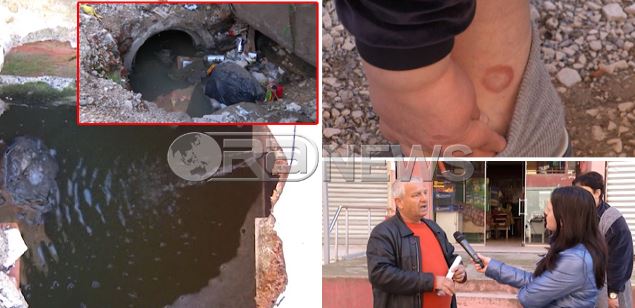 BOOM/100 familje në Astir mes ujërave të zeza