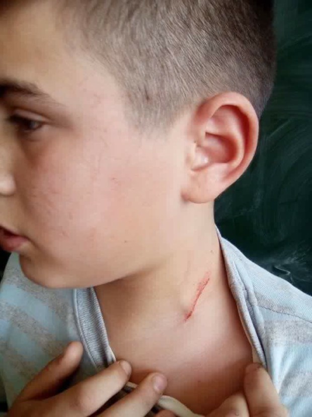 FOTO/ Mësuesi i “fut thonjtë në grykë” nxënësit!