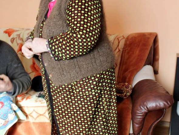 FOTO/ Thuri jelek me flokët e saj