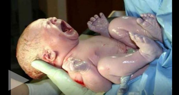 E trishtë, lind foshnja pa gjuhë në Durrës!