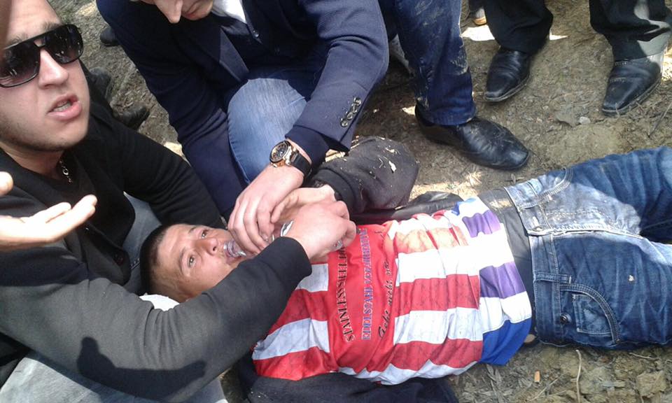 FOTO/Dhuna e policisë, protestuesit i bie të fikët