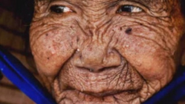 VIDEO/ Photoshop bën mrekullira, 85-vjeçarja transformohet në 25-vjeçare