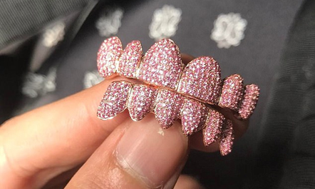 VIDEO/ Justin Bieber blen proteza, nuk jua merr mendja sa kanë kushtuar