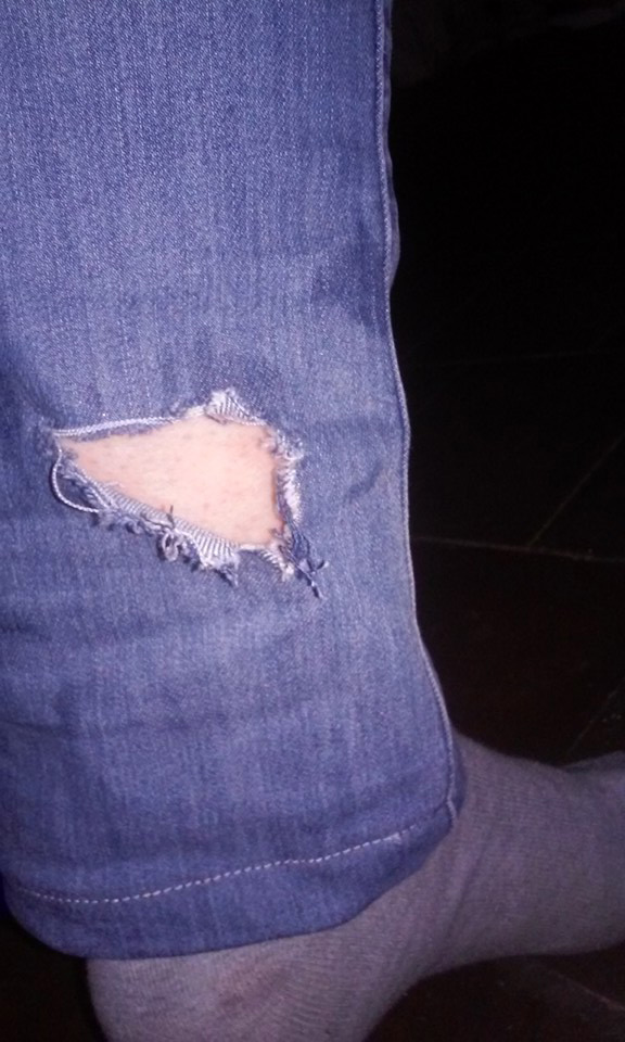 FOTO LAJM/ Në Korçë qentë me dy këmbë të pinë gjakun, ata me katër këmbë të kafshojnë