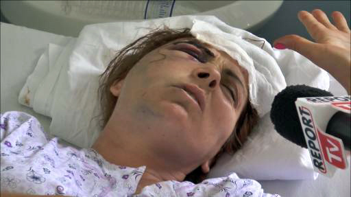 Aksidenti në Qafën e Muzinës, flet një nga të plagosurat