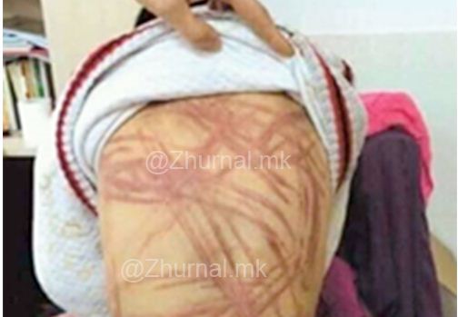 FOTO/ Gardianët e kanë masakruar shqiptarin në Shkup