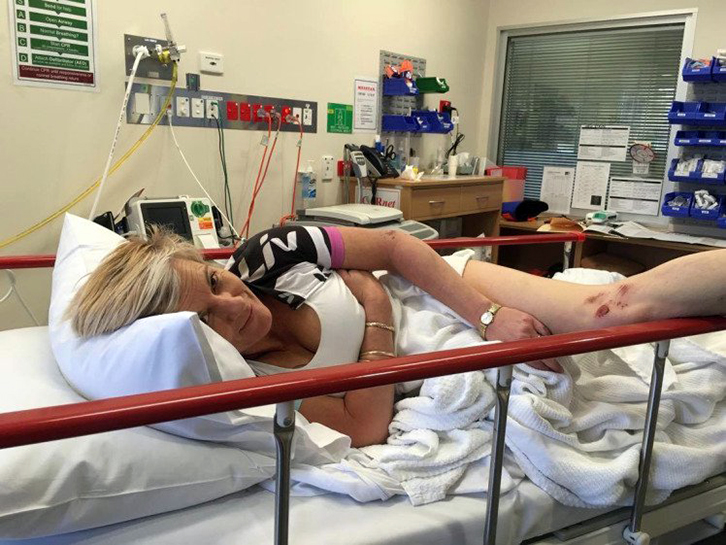 FOTO/ Silikoni në gjoks shërben për një “gjë të mirë”, kësaj gruaje i shpëtoi jetën