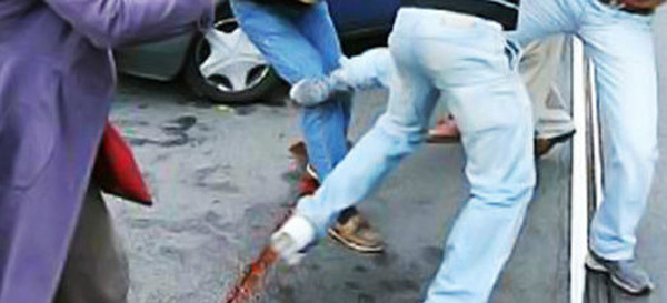 DETAJE/ Përleshja me thika pranë Parlamentit, kush ishte femra dhe pse i futi në sherr 4 meshkuj?!