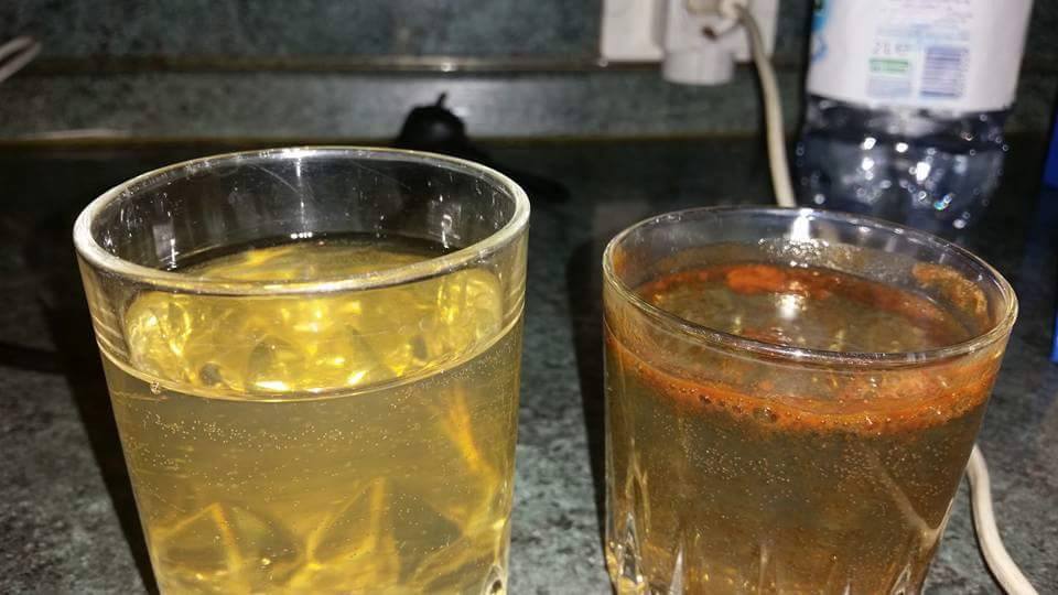 ALARMI/ Lushnjë, ujërat e zeza përzihen me ujin e pijshëm, shpërthen hepatiti A