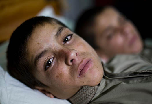 Vëllezërit që paralizohen sapo perëndon dielli