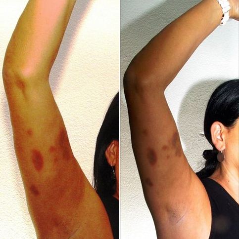 FOTO/Violeta Geca, histori dhune kundër saj që të martën, paditi në polici mikun e Velisë