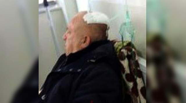 DETAJE & FOTO/ Biznesmeni në Elbasan u masakra për një kanal të ujërave të zeza