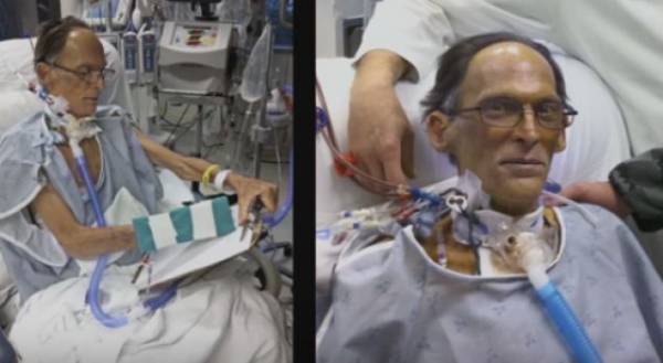 VIDEO/ Njeriu i parë pa zemër, ja si jeton ai!