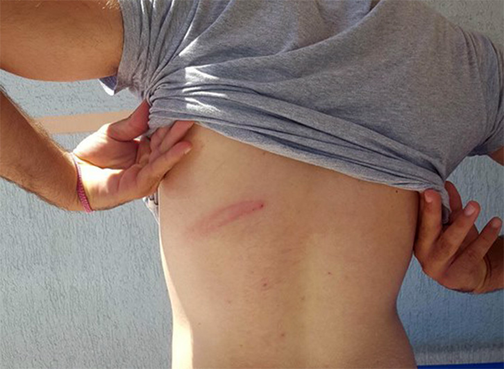 FOTO GALERI/ Fier, ja i riu i LSI-së, i dhunuar nga “horrat e PS-së”