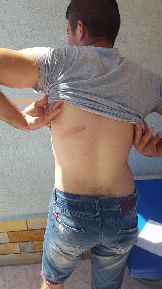 FOTO GALERI/ Fier, ja i riu i LSI-së, i dhunuar nga “horrat e PS-së”