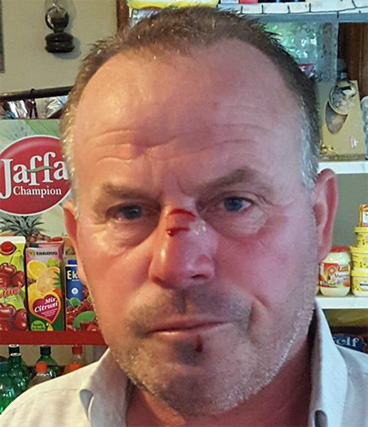 FOTO/ Korçë, masakrohet përfaqësuesi i PD-së, denoncohet socialistët