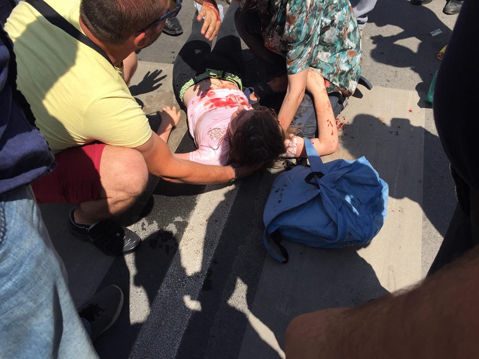 FOTO/ Elbasan, motorri përplas tmerrshëm nxënësen, ecte me shpejtësi ekstreme