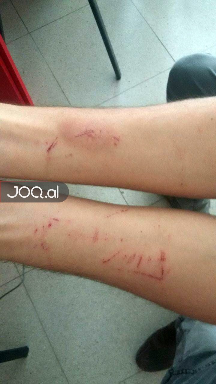 “BALENA BLU”/ 28 vjeçari bie pre e lojës, rrëfehen kolegët: E kapëm me dorë të prerë